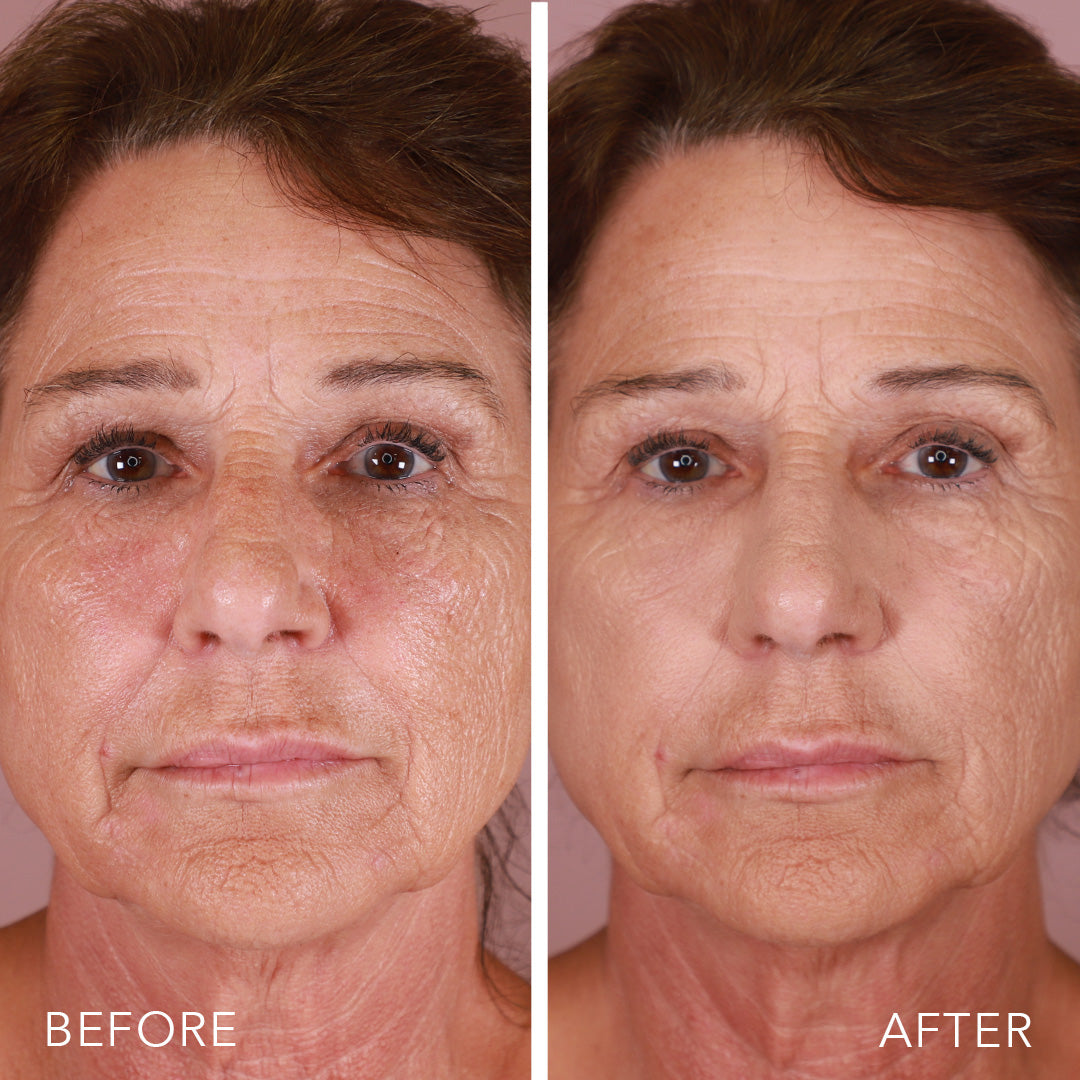 Daily Dissolve Enzyme Clay Cleanser with Reishi Mushroom – Doll 10