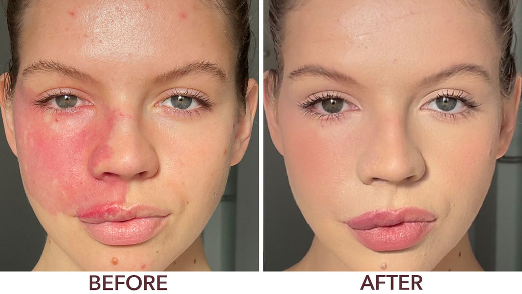Before and after picture 