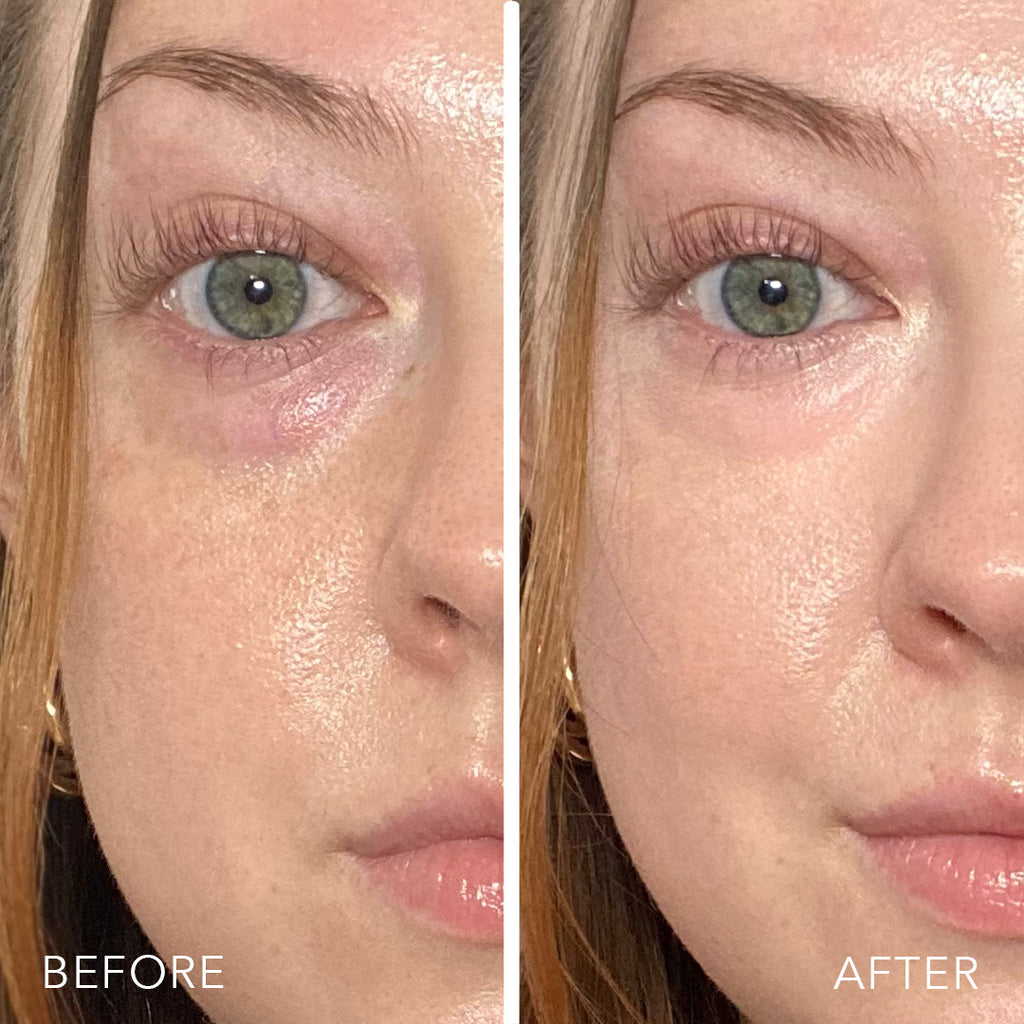 before and after of model wearing rose quartz undereye corrector 